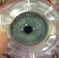 Chirurgie de la myopie : Lasik ou Lasik ?